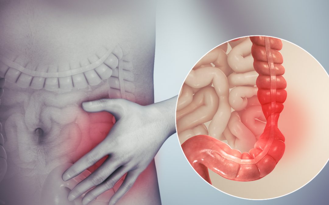 Can a personalized antibiotics, prebiotics, and probiotics combo help treat IBS?